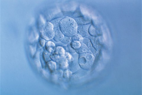 http://chengdu.quanwangkm.com/post/190.html|成都人工试管